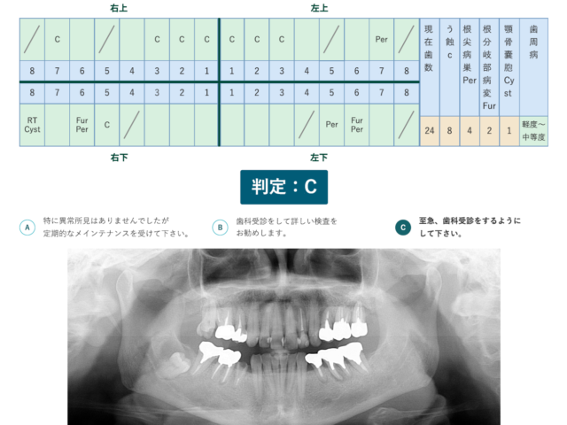 エックス線画像を活用した歯科健診サービス